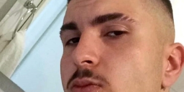 Otomobille çarpışan motosikletin sürücüsü Kasım Efe öld