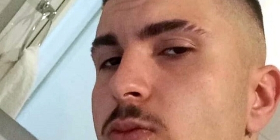 Otomobille çarpışan motosikletin sürücüsü Kasım Efe öld